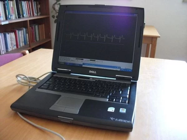 ECG on laptop