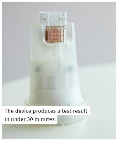 30 MINUTES HIV DETECTION USING USB STICK