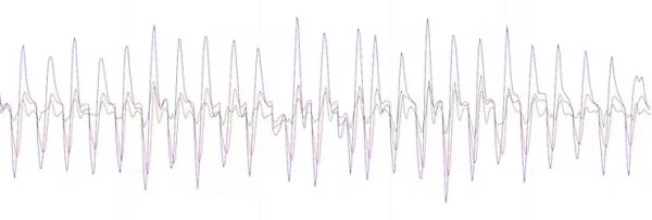 Choosing a threshold value